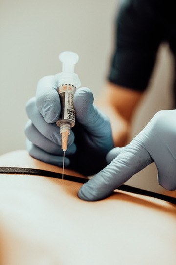 Close-up of Nurse Practitioner administering PRP injection at Juvenescence Wellness in Lake Cowichan, BC